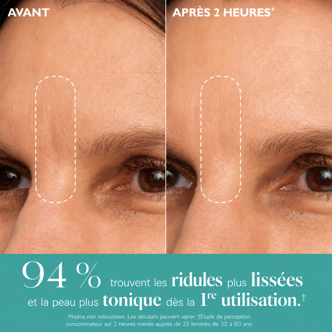 Patchs visage & yeux Le regard reposé, sans aiguille.
