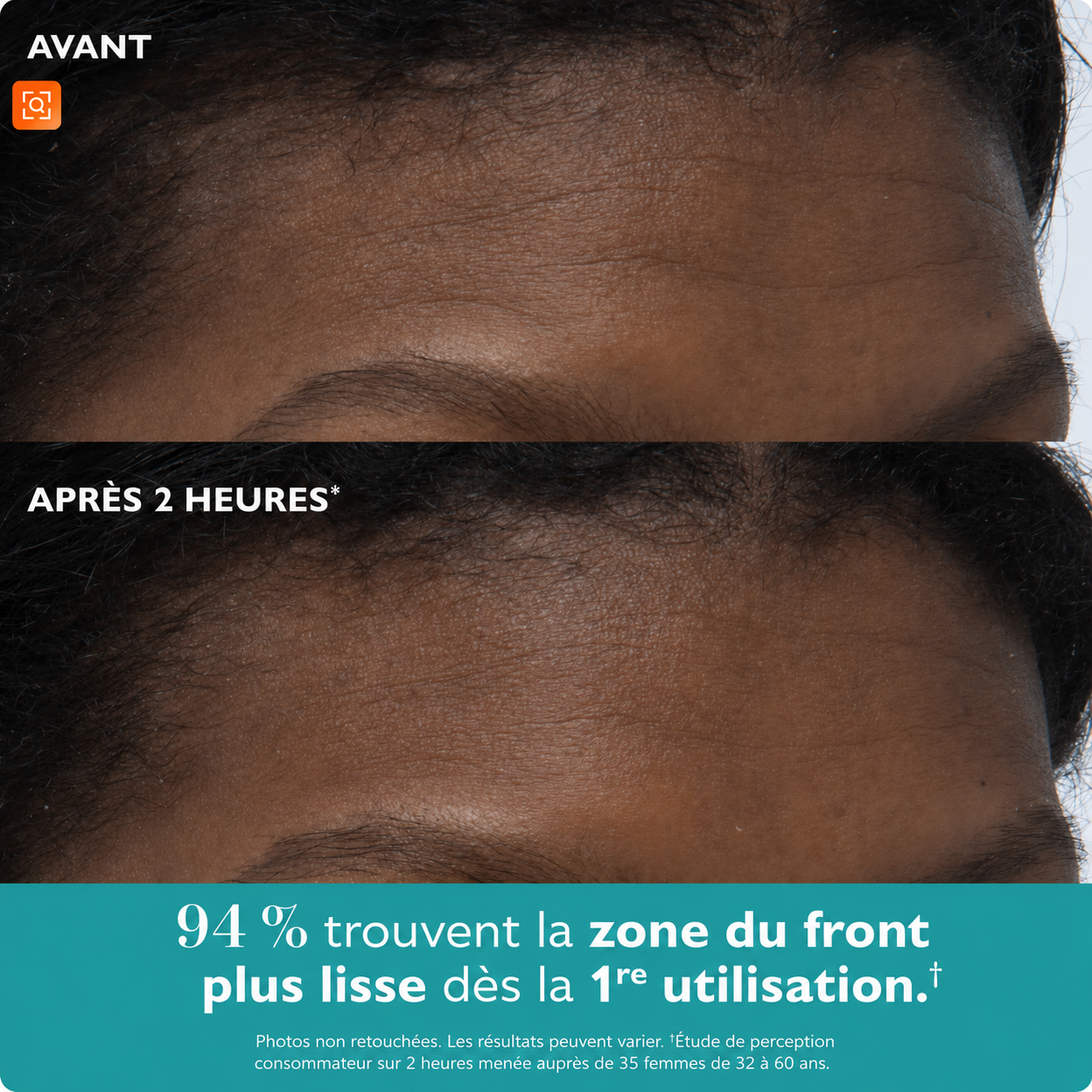 Patchs visage & yeux Le regard reposé, sans aiguille.