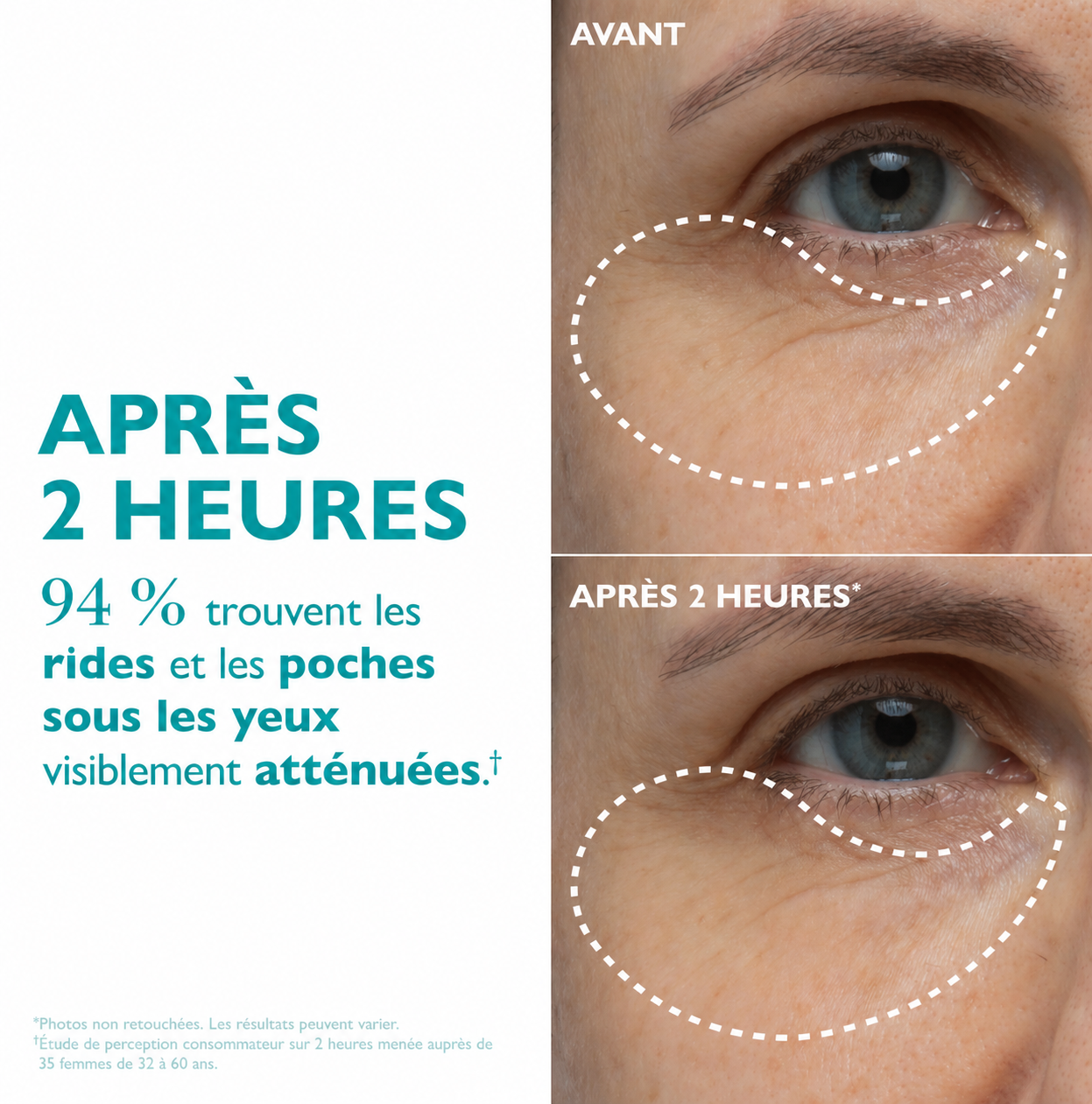 Patchs visage & yeux Le regard reposé, sans aiguille.
